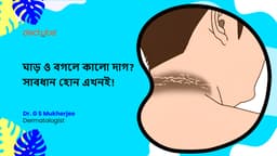 ঘাড় ও বগলে কালো দাগ? সাবধান হোন এখনই!