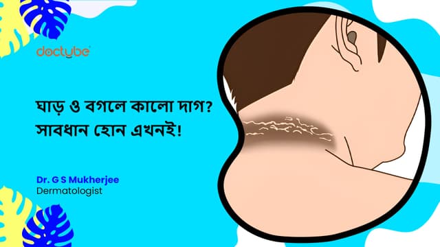 ঘাড় ও বগলে কালো দাগ? সাবধান হোন এখনই!
