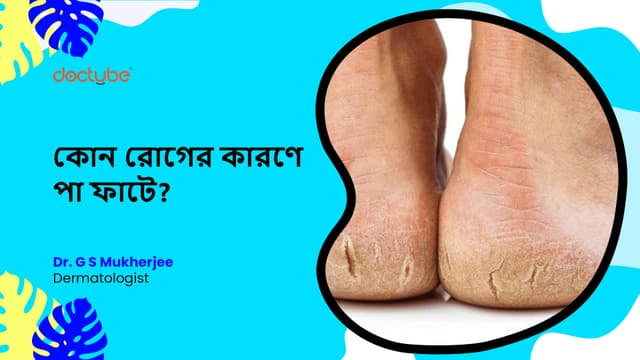 কোন রোগের কারণে পা ফাটে?