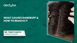 What Causes Dandruff &amp; How to Remove It