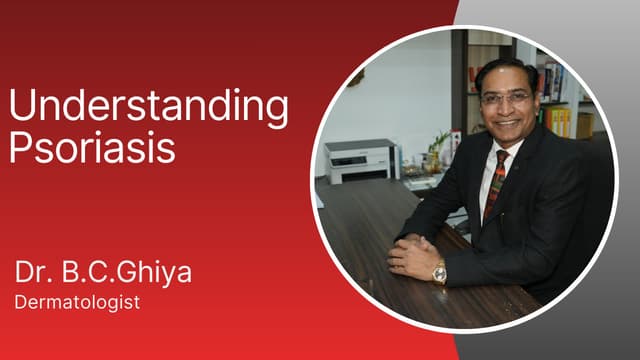 सोरायसिस: इलाज के विकल्प और बायोलॉजिक्स के बारे में जानें