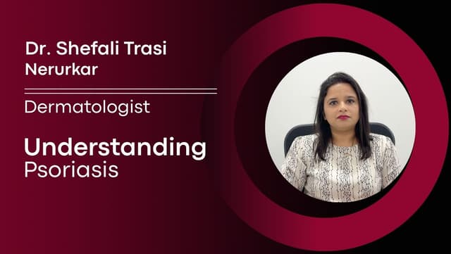 Understanding Psoriasis