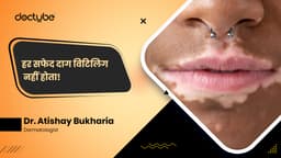 हर सफेद दाग विटिलिगो नहीं होता!