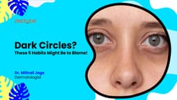 Dark Circles? These 5 Habits Might Be to Blame!