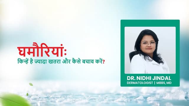 घमौरियांः किन्हें है ज्यादा खतरा और कैसे बचाव करें?