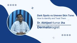 Dark Spots vs Uneven Skin Tone: How to Identify and Treat Them