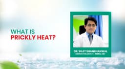 What is Prickly Heat?