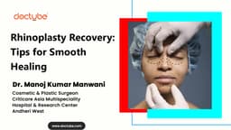 Rhinoplasty Recovery: Tips for Smooth Healing