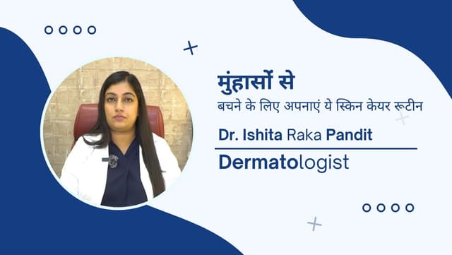 मुंहासोंं से बचने के लिए अपनाएं ये स्किन केयर रूटीन