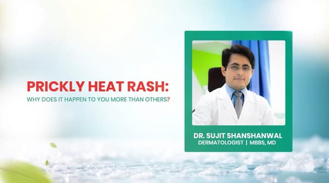 Prickly Heat Rash: Why Does It Happen to You More Than Others?