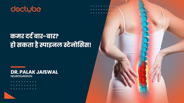कमर दर्द बार-बार? हो सकता है स्पाइनल स्टेनोसिस!