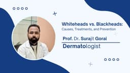 Whiteheads vs. Blackheads: Causes, Treatments, and Prevention