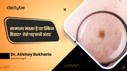 सामान्य मस्सा है या स्किन कैंसर?  ऐसे पहचानें अंतर