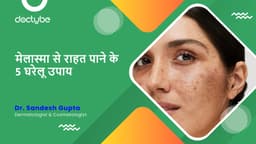 मेलास्मा से राहत पाने के 5 घरेलू उपाय