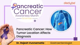 Pancreatic Cancer: How Tumor Location Affects Diagnosis