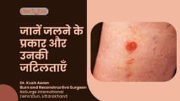 जानें जलने के प्रकार और उनकी जटिलताएँ