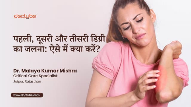 पहली, दूसरी और तीसरी डिग्री का जलना: ऐसे में क्या करें?