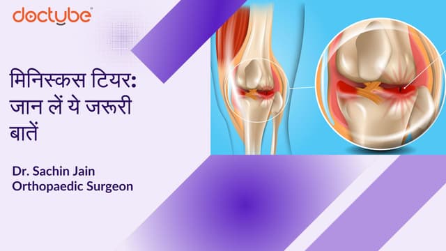 मिनिस्कस टियर: जान लें ये जरूरी बातें