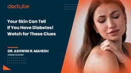 Your Skin Can Tell If You Have Diabetes! Watch for These Clues