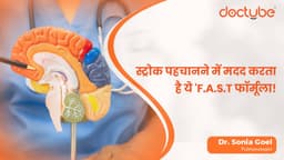 स्ट्रोक पहचानने में मदद करता है ये F.A.S.T फॉर्मूला!