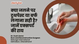 क्या जलने पर टूथपेस्ट या बर्फ लगाना सही है? जानें एक्सपर्ट की राय