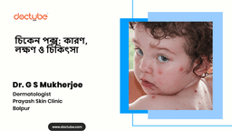 চিকেন পক্স: কারণ, লক্ষণ ও চিকিৎসা