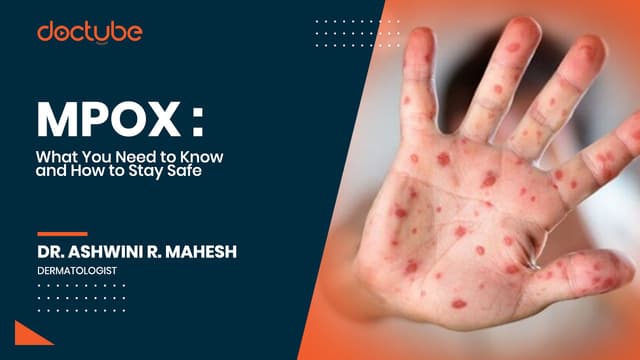MPOX – What You Need to Know and How to Stay Safe