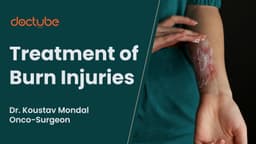 Treatment of Burn Injuries