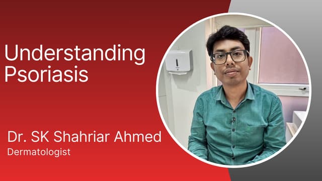 Understanding Psoriasis