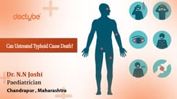 Can Untreated Typhoid Cause Death? Can Untreated Typhoid Cause Death?
